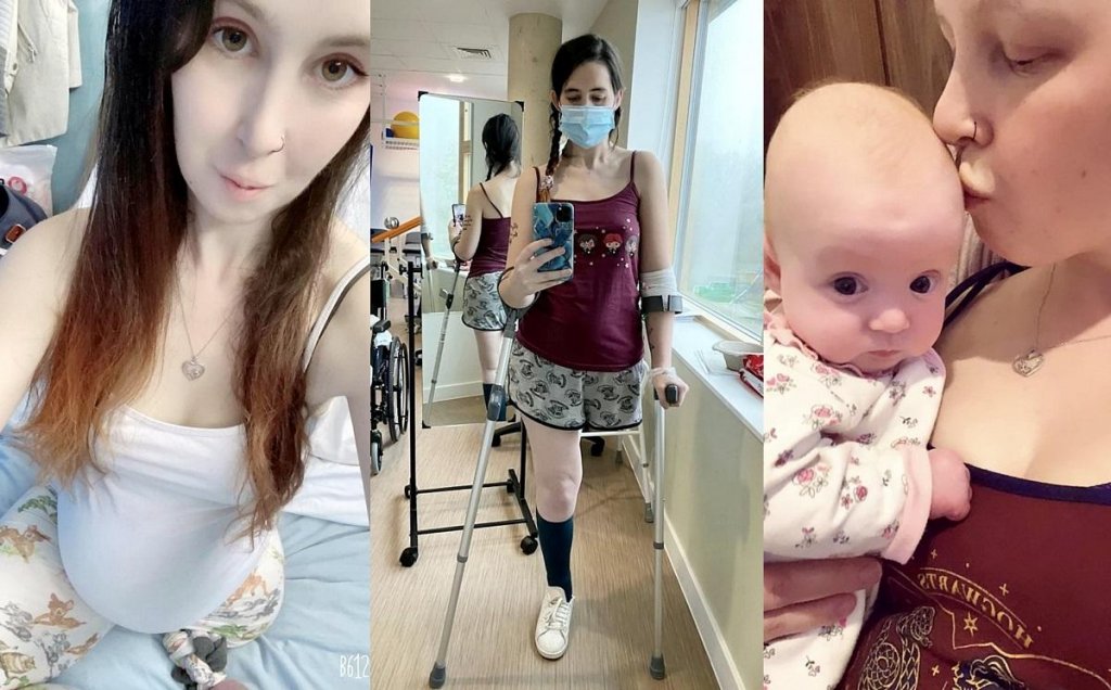 O mamă cu cancer și-a amputat picioru pentru a-și salva copilul din burtă: „Aş mai putea trăi câteva luni ori câţiva ani. Nu contează"