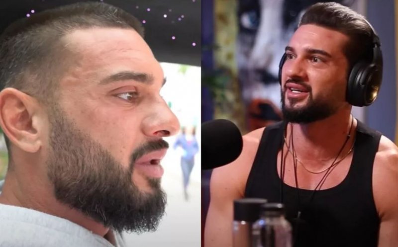 Dorian Popa se pregătește pentru o nouă intervenție estetică: „acum la 33 de ani..”
