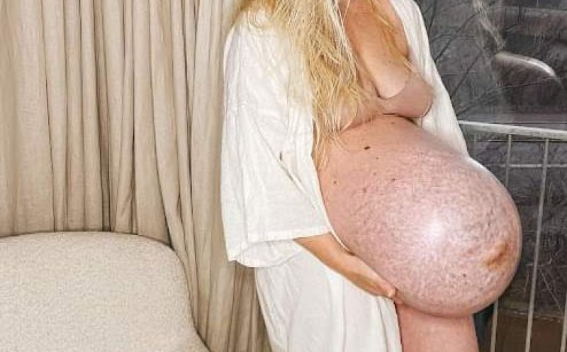 O femeie care și-a pozat burta de graviduță a șocat întregul internet. Care este adevărul din spatele acestei fotografii!