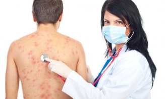 COVID-19 afectează pielea pacienţilor. Care sunt cele mai dese manifestări cutanate provocate de infecţia cu SARSCoV-2