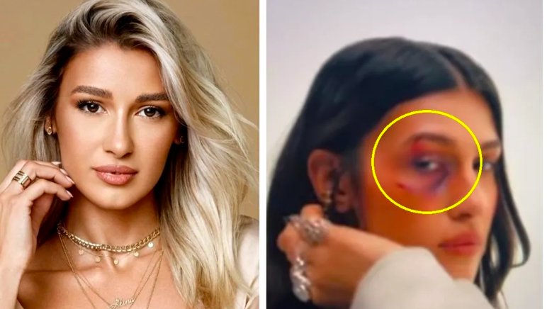 Alina Eremia a fost agresată fizic de „iubit”, chiar în fața camerelor: „Violența lasă urme”