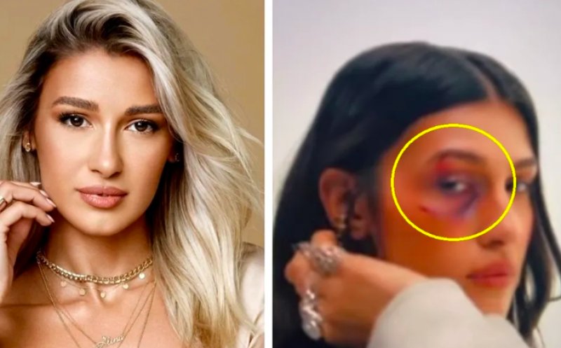 Alina Eremia a fost agresată fizic de „iubit”, chiar în fața camerelor: „Violența lasă urme”