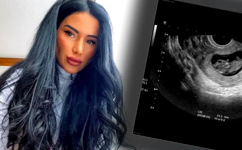 S-A AFLAT! Băiat sau fetiță? Ce va avea Daniela Crudu: „Doamna doctor a spus că e…”